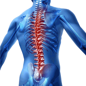 drawing of a person with inflamed spine