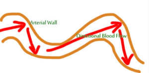 Diagram of artery with arrows representing directional blood flow damage