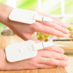 Photo of a patient's hands with low current electrical therapy pads